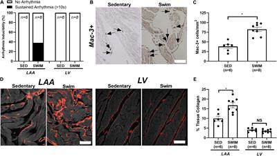 Transcriptomic Bioinformatic Analyses of Atria Uncover Involvement of Pathways Related to Strain and Post-translational Modification of Collagen in Increased Atrial Fibrillation Vulnerability in Intensely Exercised Mice